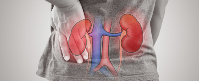 Acute Kidney Injury