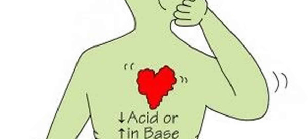 Metabolic Alkalosis