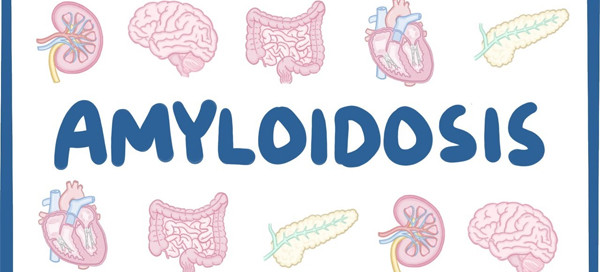 Amyloidosis
