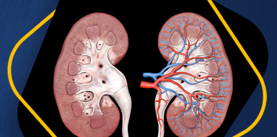 Diabetic Nephropathy