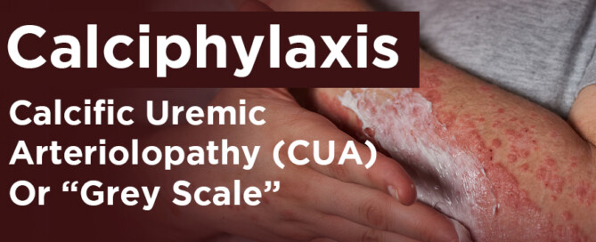 calciphylaxis