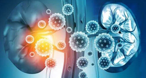 Chronic Kidney Disease