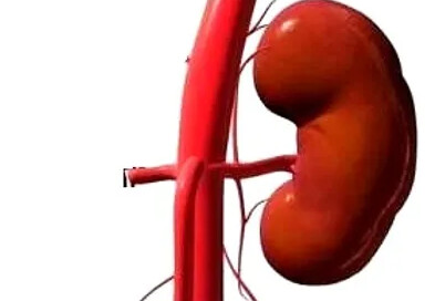 Solitary Kidney