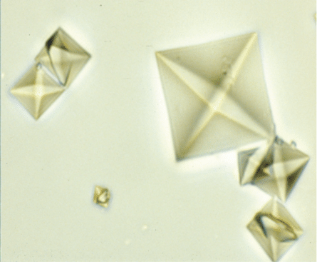calcium oxalate dihydrate crystal
