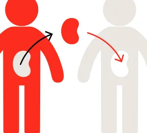 Kidney Transplant Immunology