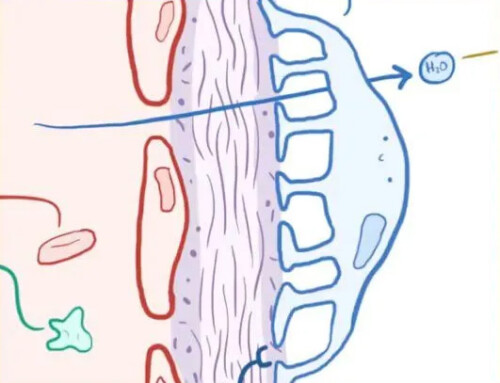 Alport Syndrome