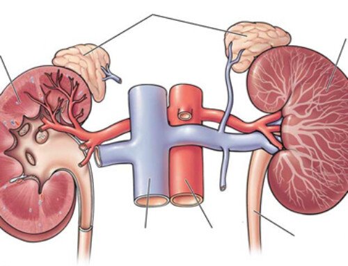 Primary Hyperaldosteronism