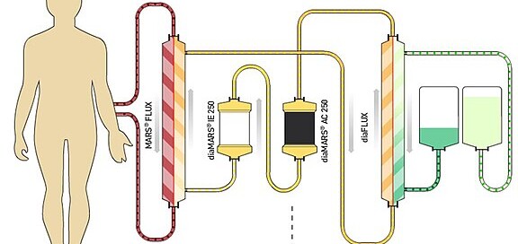 Dialysis for Liver Failure